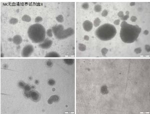 使用Corning? NK細胞無血清培養試劑盒II 高效地激活和擴增人類自然殺傷細胞 應