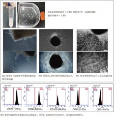 分離及培養(yǎng)臍帶來源間 充質(zhì)干細(xì)胞