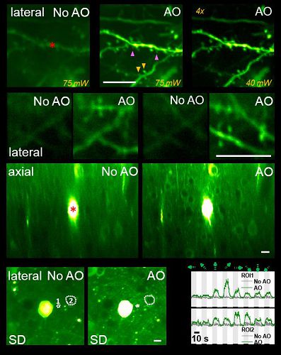 Nature方法:中美合作成功研制新型自適應光學雙光子熒光顯微鏡