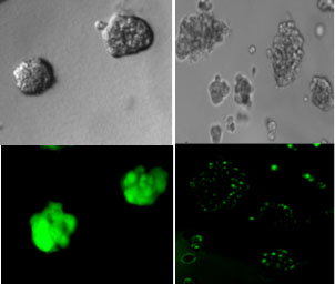 PLOS ONE:細菌的“通訊系統”可用于阻止或殺死癌細胞